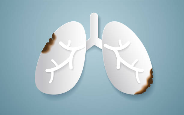 istock Lung cancer in the paper style. Stop smoking. 1022282602