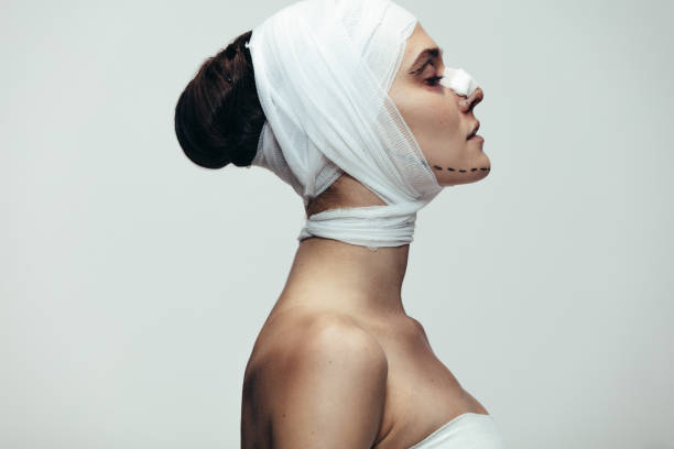 donna in benda dopo chirurgia plastica sul viso - plastic surgery bandage surgery women foto e immagini stock
