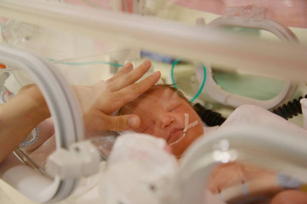 istock NICU Baby with downsyndrome 1023212044