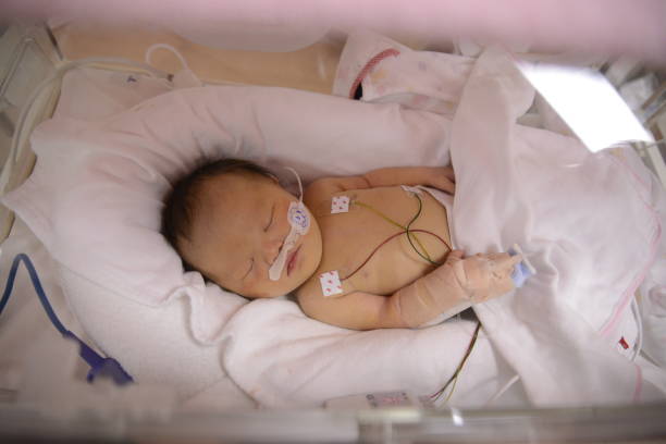 istock NICU Baby with downsyndrome 1023212054