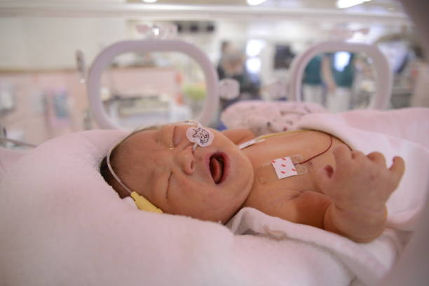 istock NICU Baby with downsyndrome 1023212062