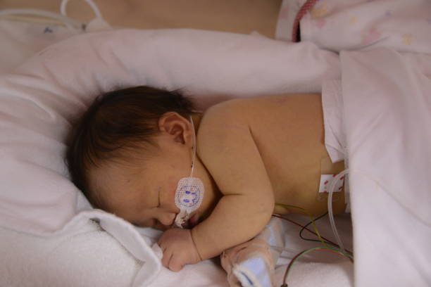 istock NICU Baby with downsyndrome 1023212066