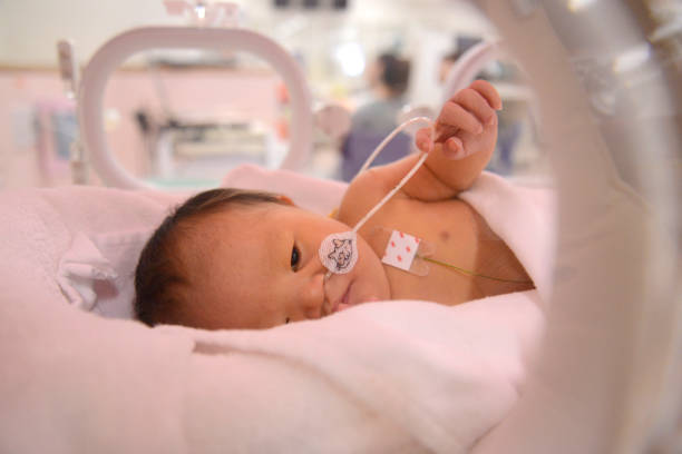 istock NICU Baby with downsyndrome 1023212068