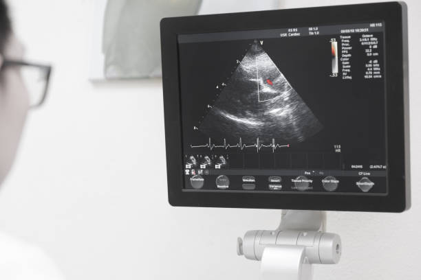 istock Close up of an image on computer screen of ultrasound scanning machine 1023372686