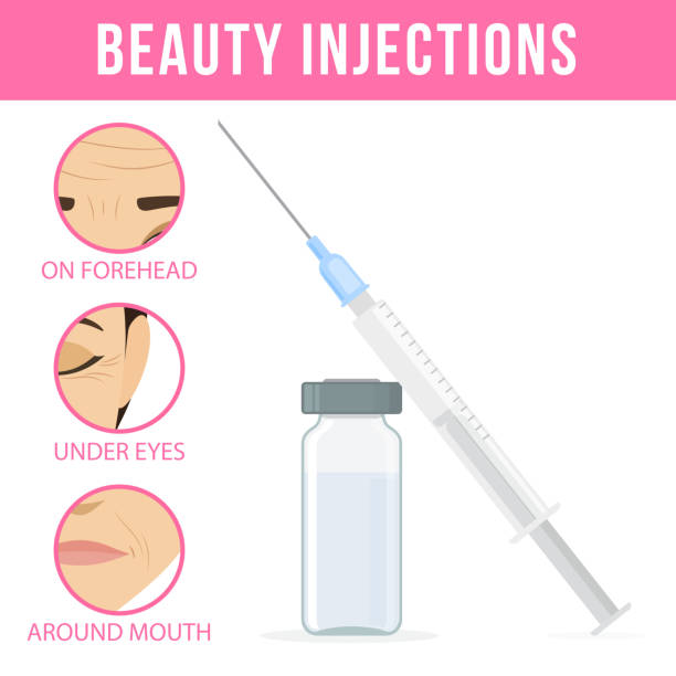 Cosmetic procedures botox Women anti-aging skin care. Different types of facial wrinkles. Botox injection, ampoule and syringe. Anti-aging procedure. Vector botox bottle stock illustrations