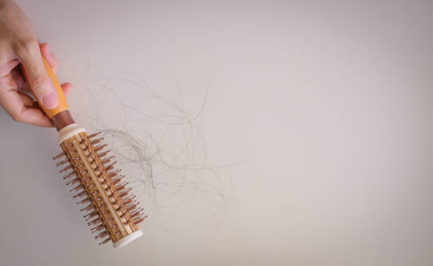 istock hair fall and lost alopecia woman problem on the comb. 1023834562