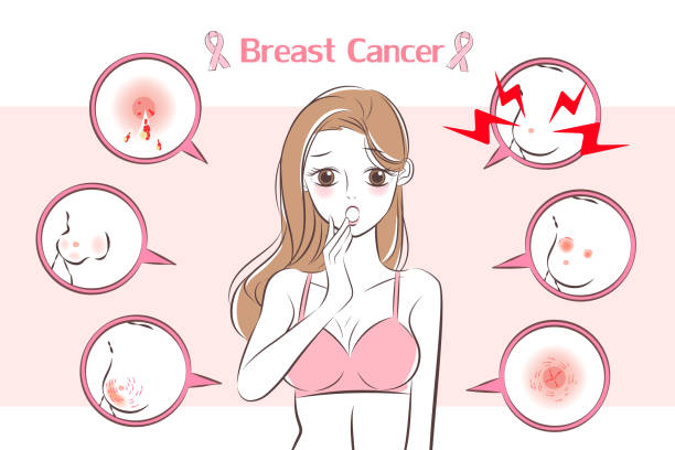 illustrazioni stock, clip art, cartoni animati e icone di tendenza di donna con sintomo di cancro al seno - lactiferous duct