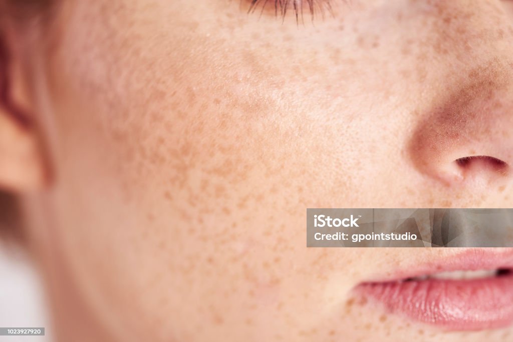 Close up of woman's face with freckles Freckle Stock Photo