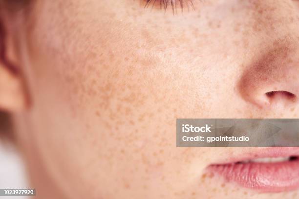 Close Up Of Womans Face With Freckles Stock Photo - Download Image Now - Freckle, Human Face, Close-up