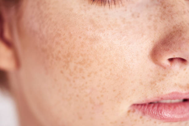 close-up do rosto de mulher com sardas - aspecto da epiderme - fotografias e filmes do acervo