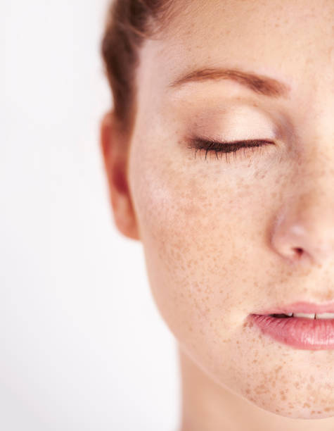 istock Half of woman's face with freckle 1023928260