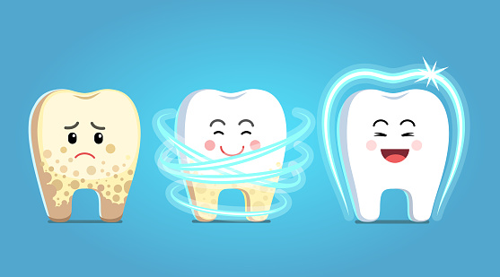 Upset tooth character with plaque gets treatment, becomes healthy, shiny & protected. Dental plaque removal procedure steps. Teeth dentistry protection, dental care clipart. Flat vector illustration