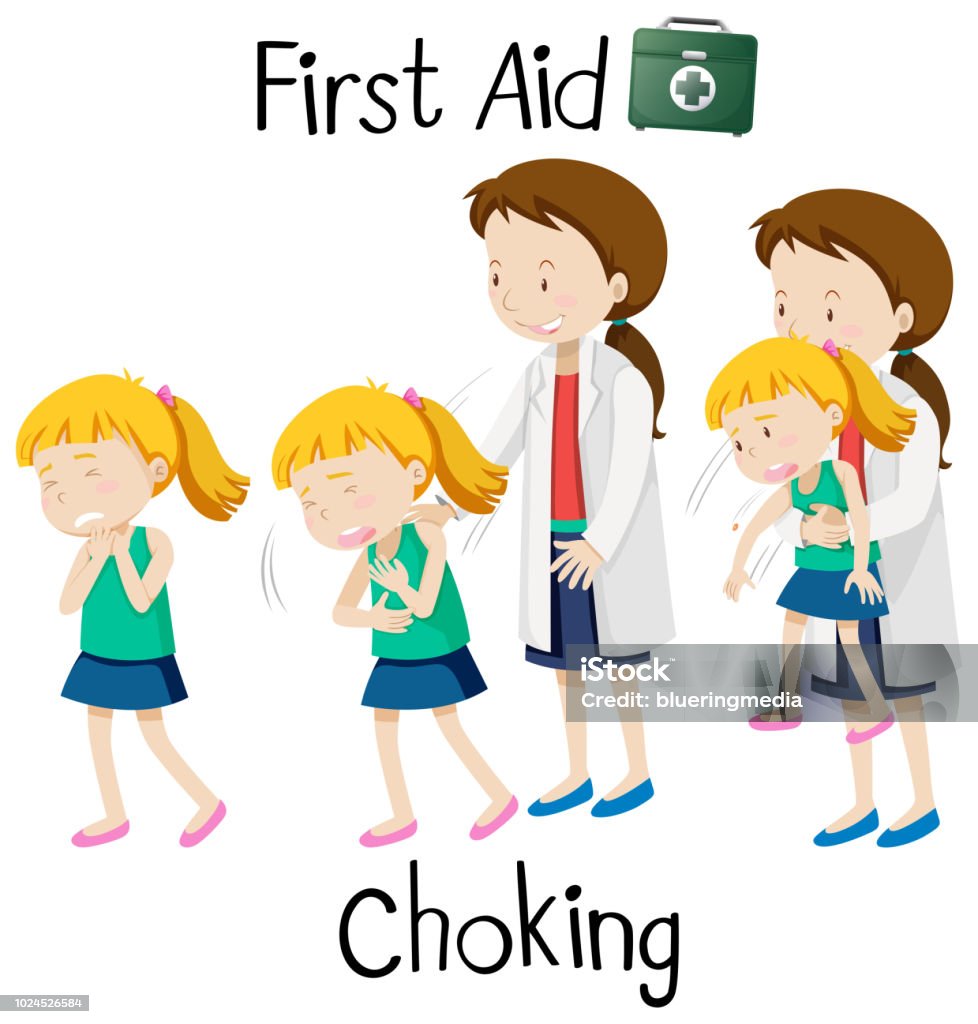 Chocking Vector First Aid For Chocking Stock Illustration - Download Image Now ...