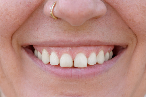 Close up studio shot of the teeth of a happy middle-aged woman