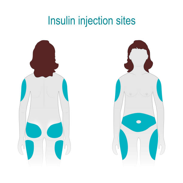 insulin-spritze sehenswürdigkeiten - senseless stock-grafiken, -clipart, -cartoons und -symbole