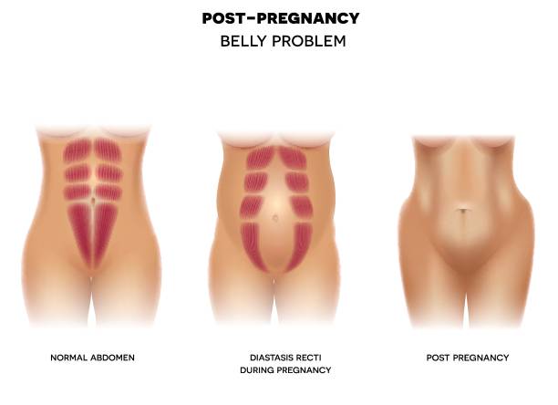 weiblichen körper vor der schwangerschaft, während der schwangerschaft und nach der - bauchnabel stock-grafiken, -clipart, -cartoons und -symbole
