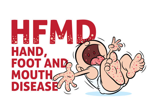Crying baby with hand, foot and mouth disease or HFMD illustration Crying baby infected with HFMD or hand, foot and mouth disease illustration hand foot and mouth disease stock illustrations