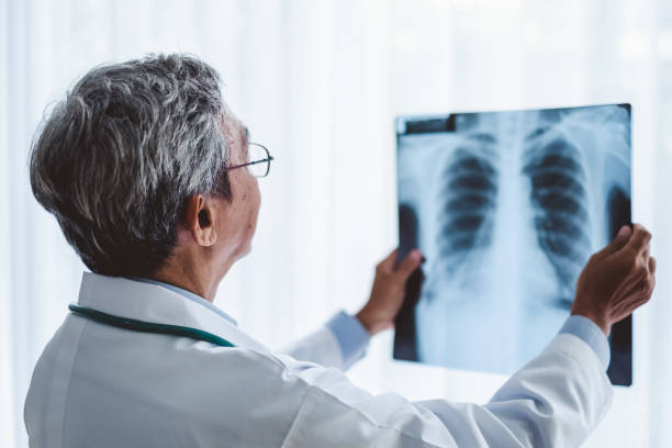 아시아 남자 의사 진단 환자의 x 선 방사선 필름, 아시아 의료 개념 - x ray light 뉴스 사진 이미지