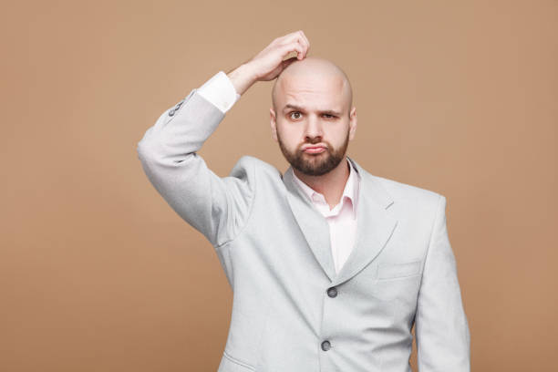 5,555 Balding Funny Stock Photos, Pictures & Royalty-Free Images - iStock |  Comb over