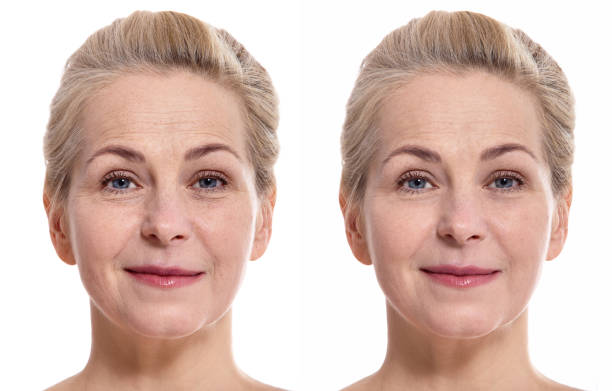 middle aged woman face before and after cosmetic procedure. plastic surgery concept. - rebellion aging process facial mask beauty treatment imagens e fotografias de stock