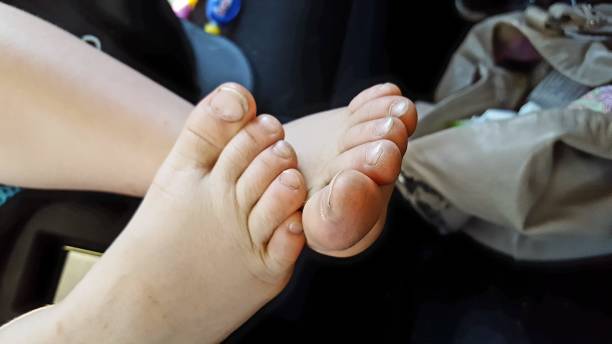 istock Toddlers feet 1026918286