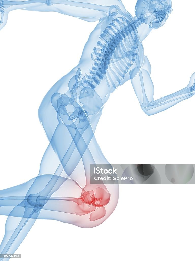 painful knee illustration  Pain Stock Photo