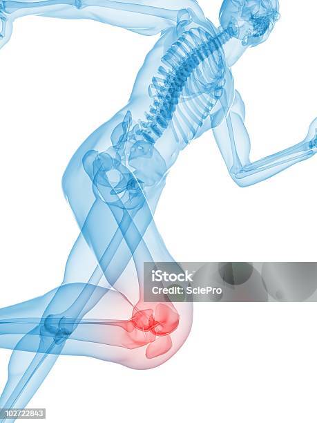 Painful Knee Illustration Stock Photo - Download Image Now - Pain, X-ray Image, Orthopedic Equipment