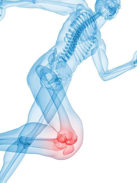 bolesne kolana ilustracja - x ray human knee orthopedic equipment human bone zdjęcia i obrazy z banku zdjęć