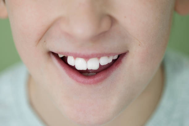 istock Toothy Smile of a Child 1027358842