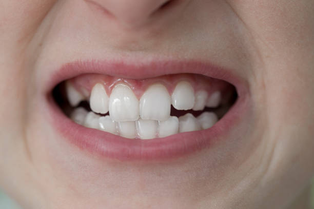 istock Toothy Smile of a Child 1027358850