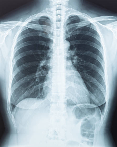 radiografía de la radiografía del cuerpo físico humano con proyección de imagen digital de la película mostrando el órgano interno de la enfermedad de mujer paciente salud (pulmón, corazón, esqueleto de la columna vertebral) para análisis diagnós - imagen de rayos x fotos fotografías e imágenes de stock