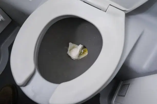 Photo of toilet in airplane