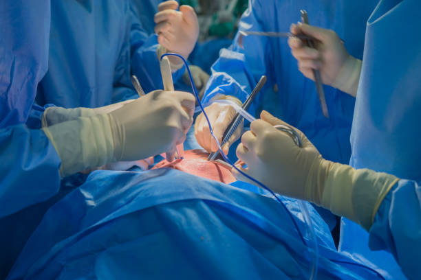 ärzte team tragen blaue mantel führen herzchirurgie in den op-saal im krankenhaus. - transplantation stock-fotos und bilder