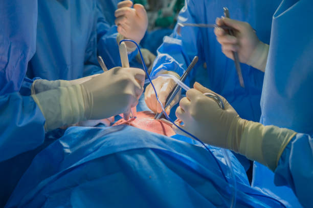 l'team dei medici indossa il cappotto blu esegue un intervento chirurgico al cuore in sala operatoria in ospedale. - operazione di trapianto foto e immagini stock