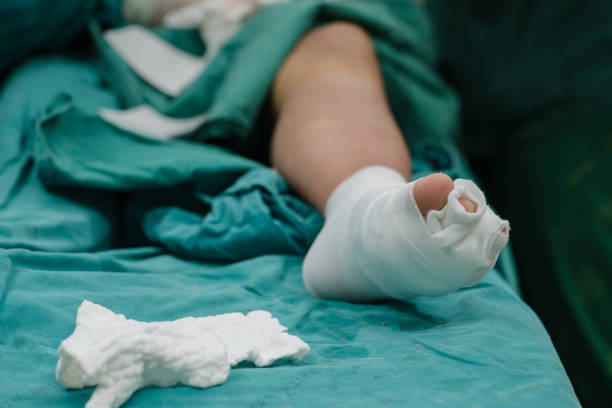 Patient's feet with bandage in the hospital. Patient's feet with bandage in the hospital. toe stock pictures, royalty-free photos & images