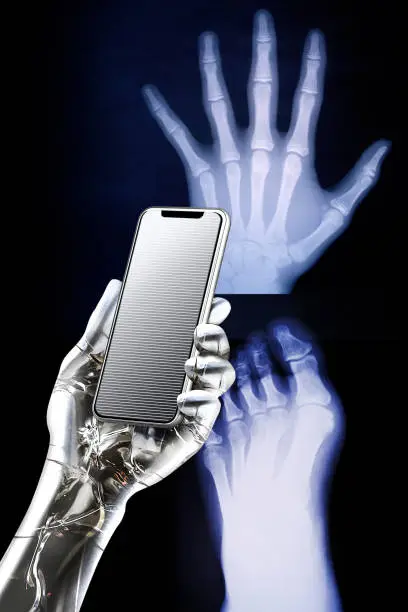 Photo of A metallic artificial intelligence robot that examines the result with an iPhone while watching the X - ray photograph of the hands and feet.