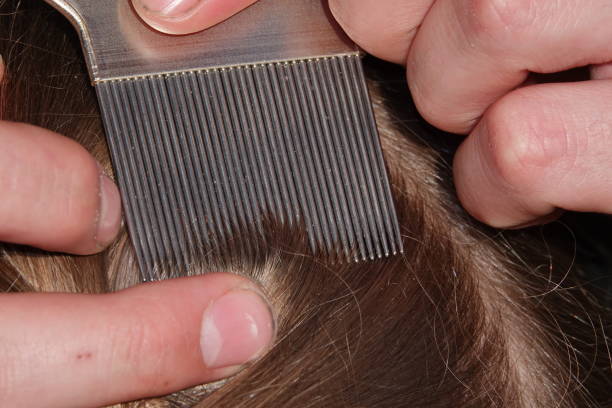 istock Checking a young girls hair for head lice 1028954074
