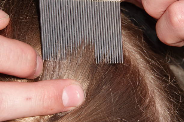 istock Checking a young girls hair for head lice 1028954094