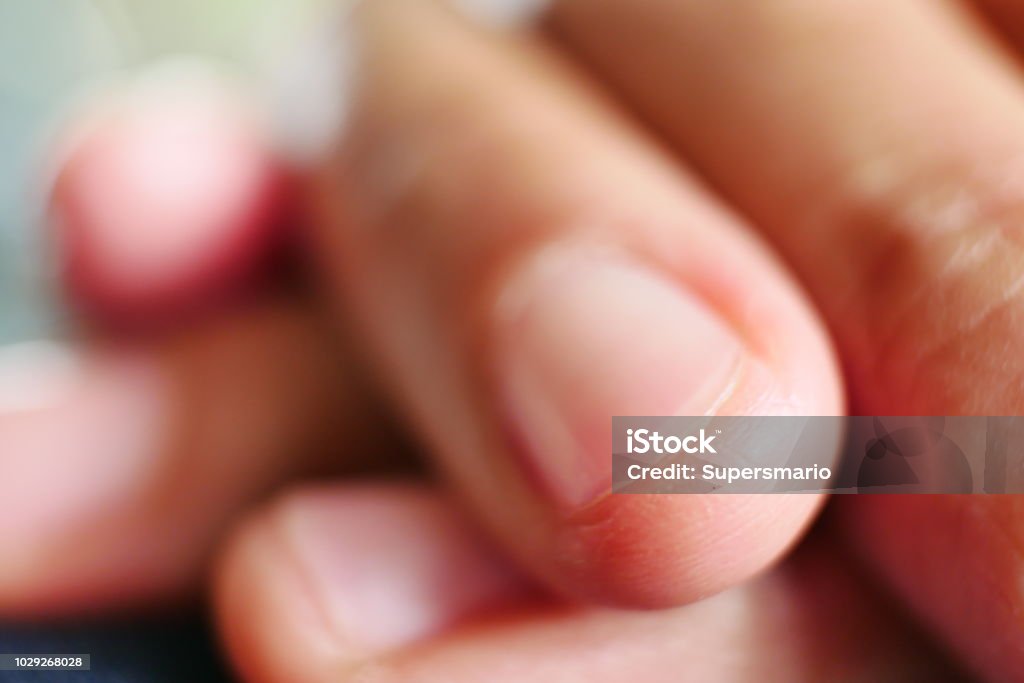 Close-up of a senior ridged Human Hand, Human Skin, Palm of Hand, Fingernail, Dry Adult Stock Photo
