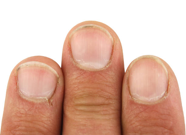 istock three male fingers with dirt under the nails, closeup macro, isolated 1029283562