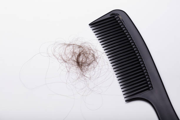 istock Black Comb With Hair Loss 1029427600