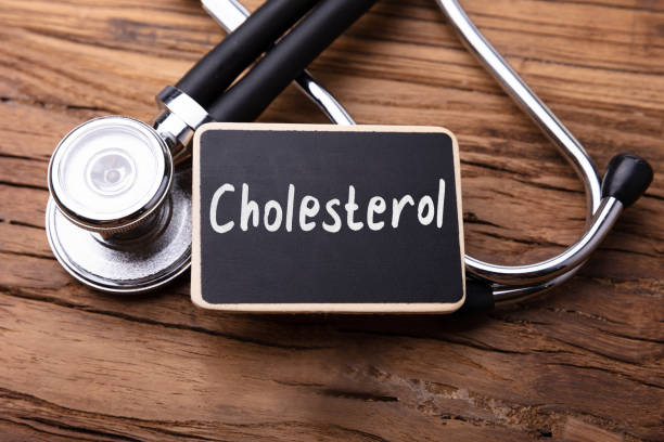 istock Cholesterol Word With Stethoscope On Wooden Table 1029428308