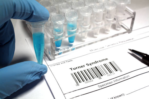 istock Turner syndrome research 1029932732