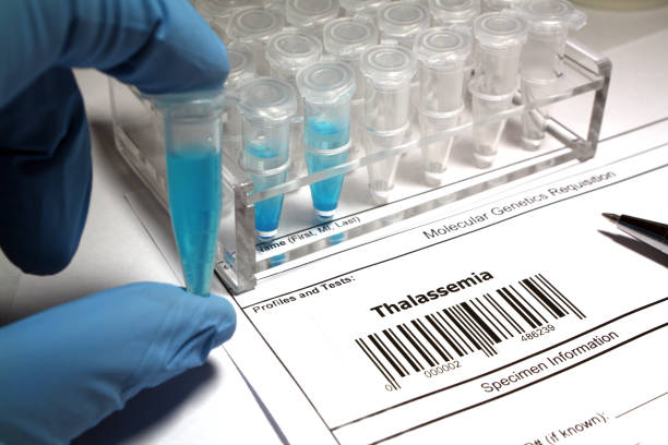 thalassemia 연구 - chromosome biotechnology laboratory tube 뉴스 사진 이미지