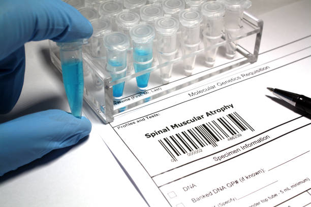 istock Spinal muscular atrophy research 1029933116