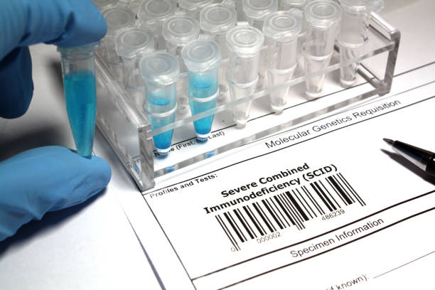istock Severe combined immunodeficiency Research 1029933330