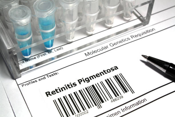 istock Retinitis pigmentosa 1029933334