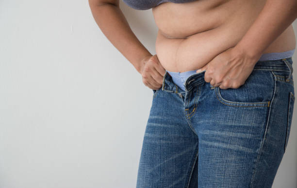istock Fat woman with belly fat getting dressed wearing jeans 1030383312