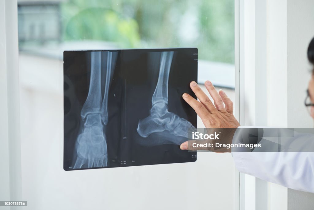 Ernte-Arzt Blick auf Röntgenbild - Lizenzfrei Röntgenbild Stock-Foto