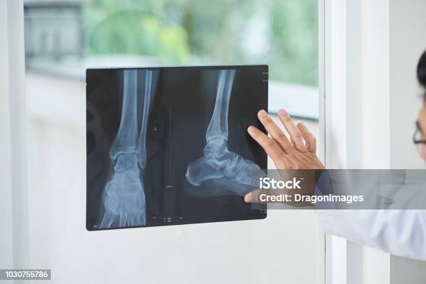 Erntearzt Blick Auf Röntgenbild Stockfoto und mehr Bilder von Röntgenbild - Röntgenbild, Fuß - Anatomiebegriff, Knöchel